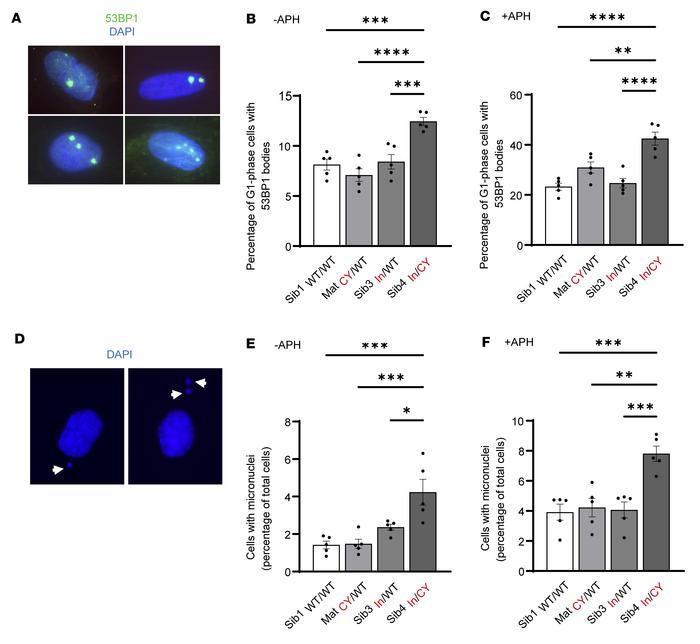 Biallelic JMJD5 pathogenic variants are associated with increased marker...