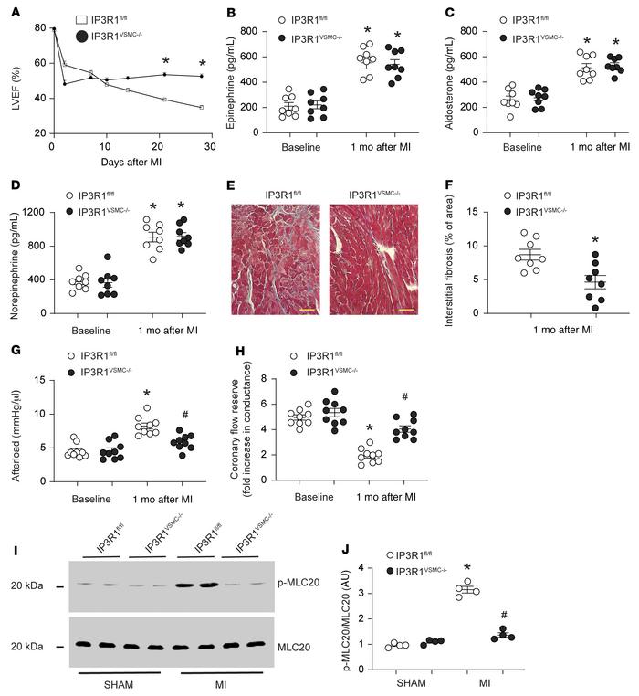 Functional role of VSMC IP3R1 in HF.
(A) LVEF evaluated by serial echoca...