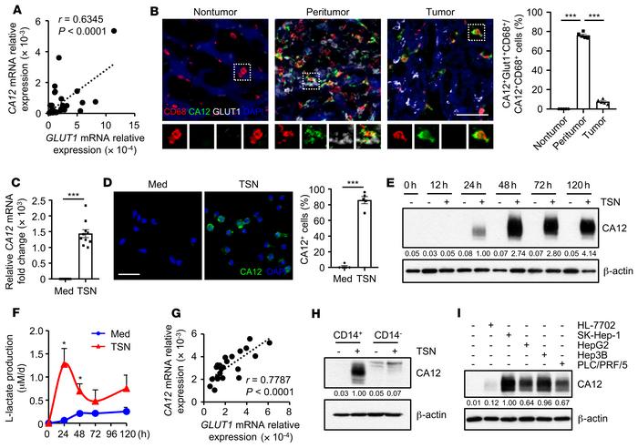 CA12 expression is positively correlated with glycolytic switch in tumor...