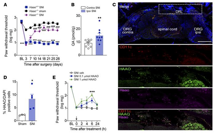 HAAO-derived QA mediates neuropathic pain through the upmodulation of NM...