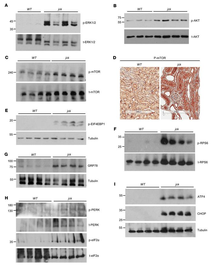 Aberrant mTOR activity, ER stress, and ISR in jck kidneys.
Representativ...