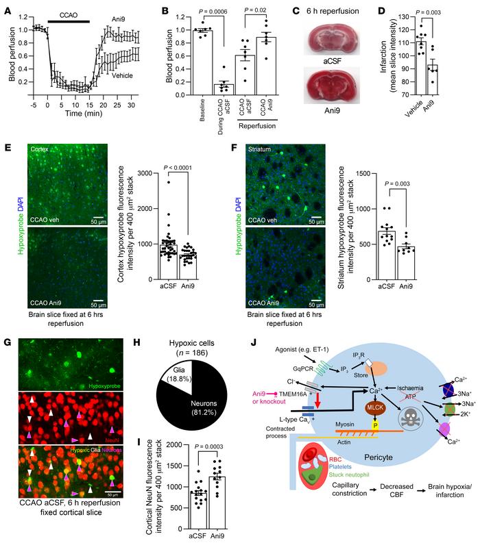 Blocking TMEM16A improves CBF and reduces neuronal hypoxia and infarct s...