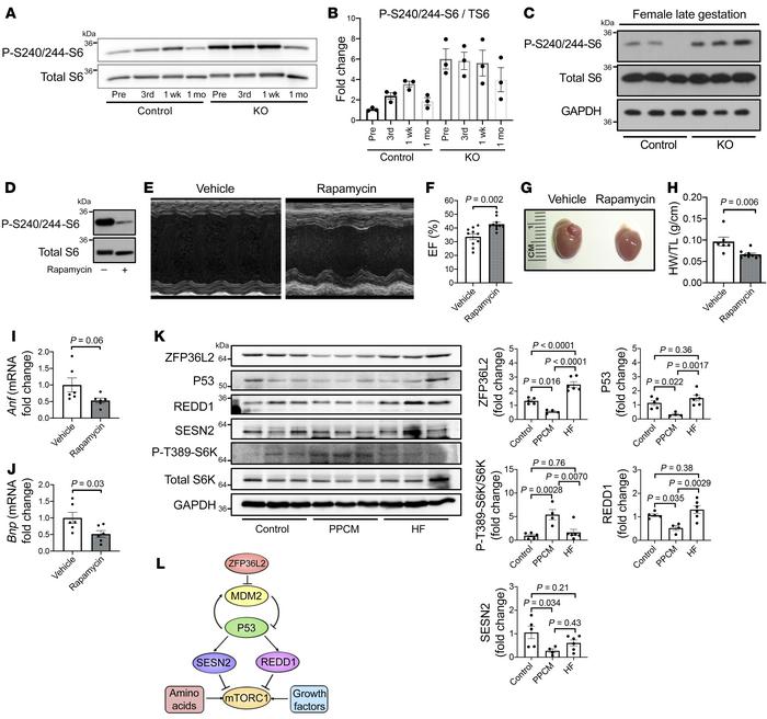 Rapamycin reverses the cardiac dysfunction that occurs in Zfp36l2-KO mic...