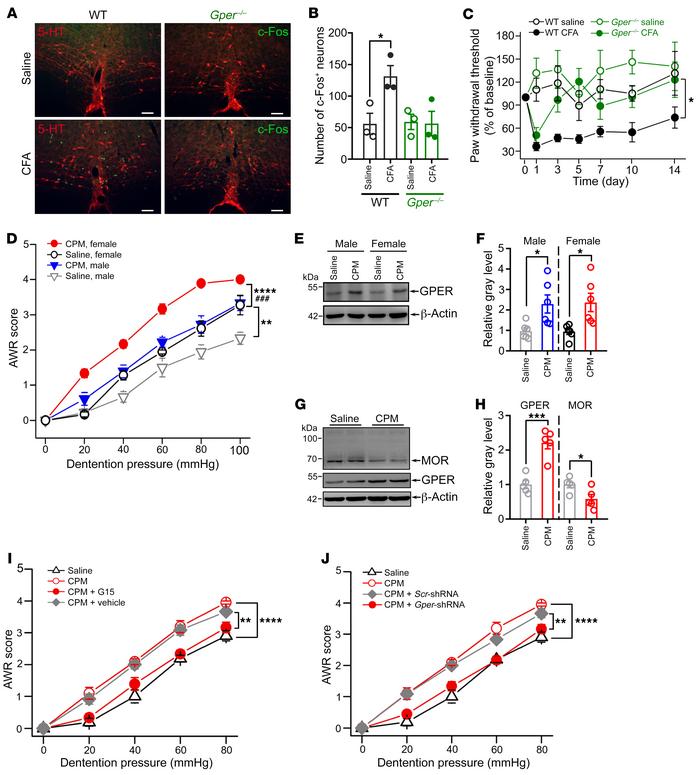 GPER drives descending facilitation of somatic and visceral pain.
(A and...