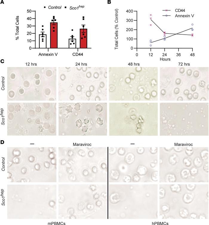 AFP promotes activation and apoptosis of both mouse and human WBCs via t...