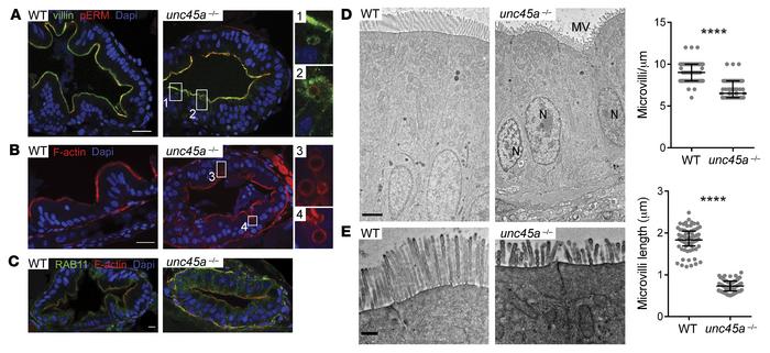 MVID features in enterocytes of unc45a zebrafish mutants.
(A–C) Confocal...