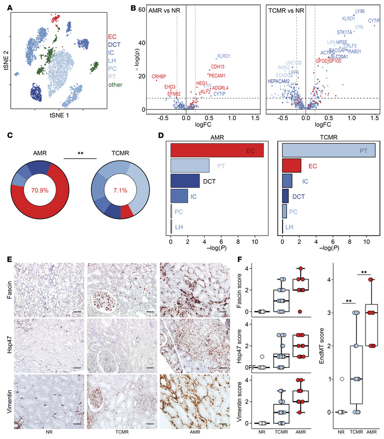 Opposite profiles of damage compartmentalization in AMR and TCMR.
(A) Un...