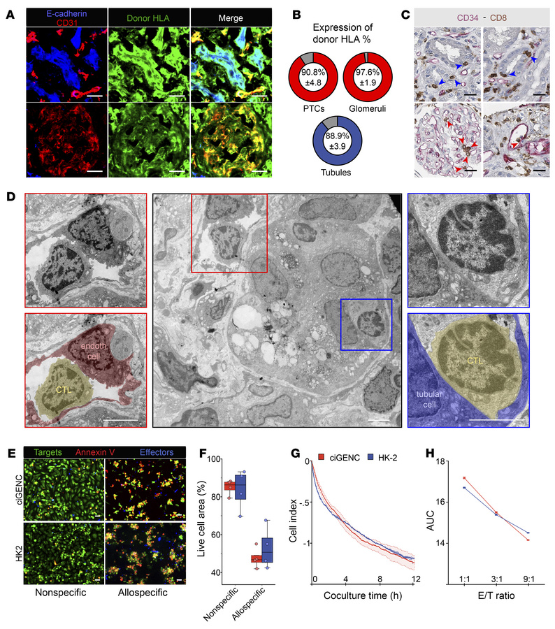 Alloreactive CTLs interact with allogeneic ECs in vivo and mediate their...