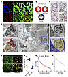 Alloreactive CTLs interact with allogeneic ECs in vivo and mediate their de