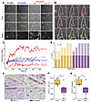 Disruption of the chemokine gradient associates with endothelial damage in