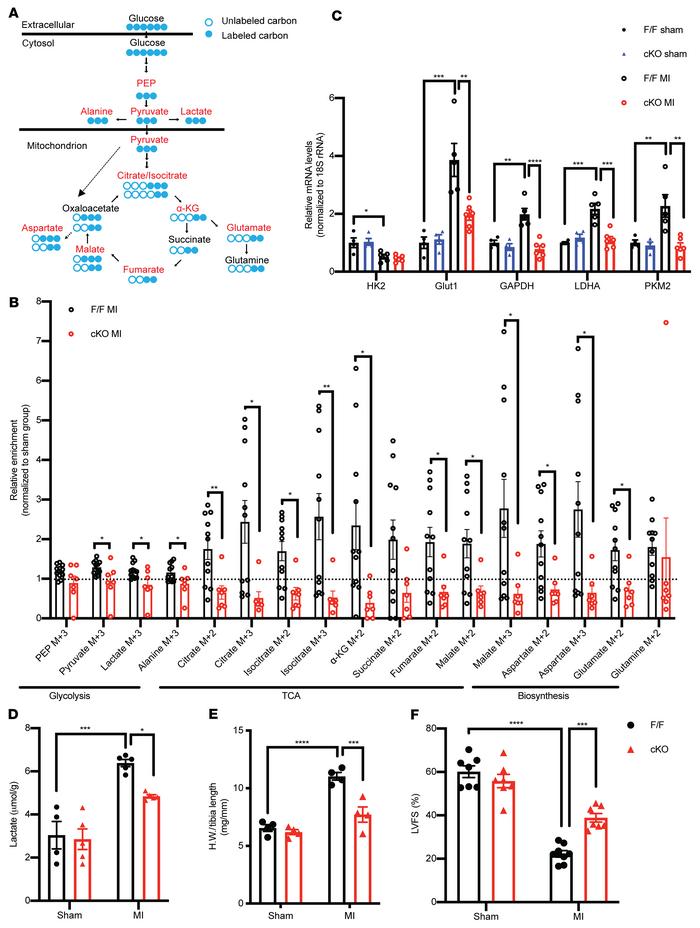Cardiac-specific deletion of ATPIF1 mitigated metabolic switch and reduc...