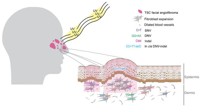 Diagram of UV effects on TSC FAF development.
Our findings suggest that ...