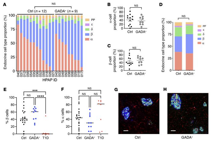 Composition of control and GADA+ donor islets.
(A–C) Endocrine cell type...