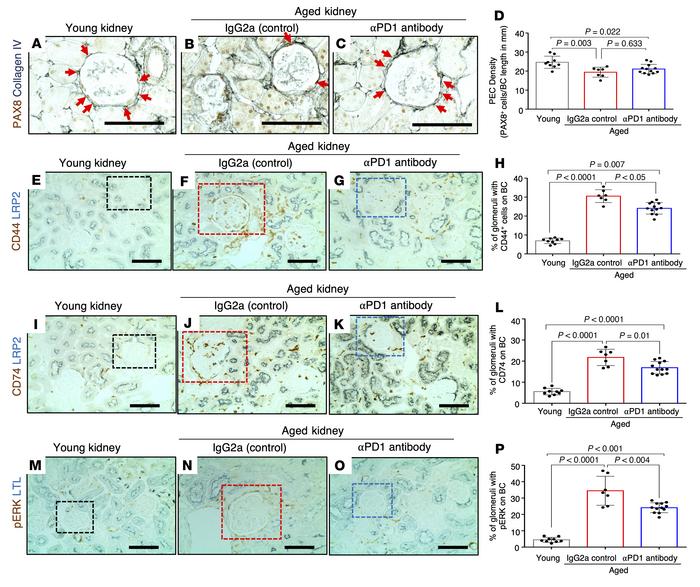 Parietal epithelial cell changes.
(A–D) Representative images of immunop...