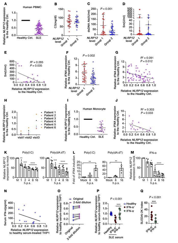 PBMCs from SLE patients exhibit low NLRP12 expression.
(A) NLRP12 expres...