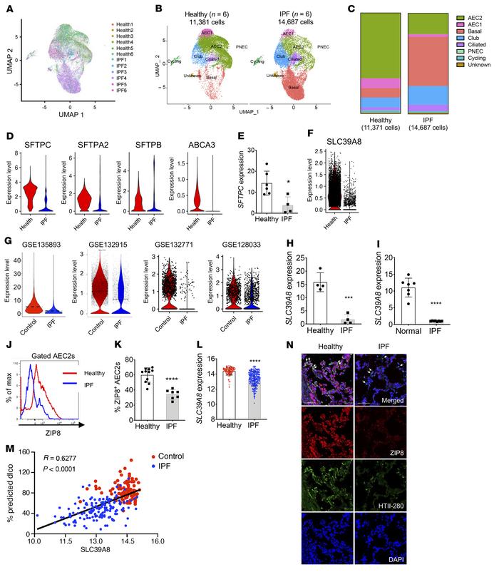 Selective loss of ZIP8 in IPF AEC2s.
(A) UMAP plots of flow-enriched EpC...