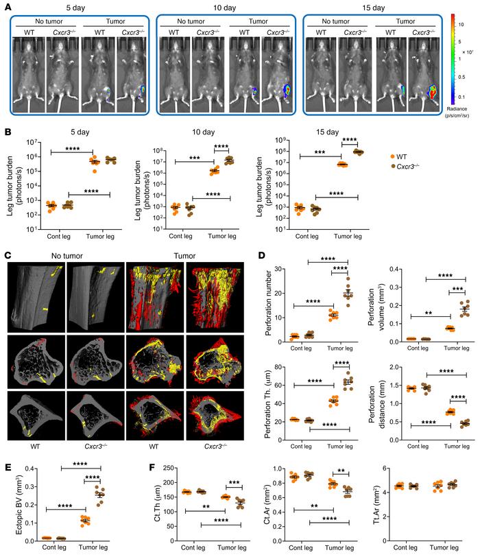 Silencing of CXCR3 accelerates bone tumor growth induced by intratibial ...