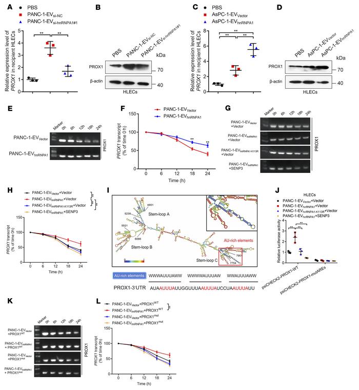 EV-packaged hnRNPA1 enhances PROX1 mRNA stability in HLECs.
(A–D) qRT-PC...