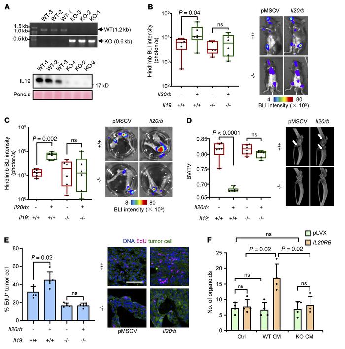 
Il19 knockout in host mice suppresses lung cancer bone metastasis.
(A) ...