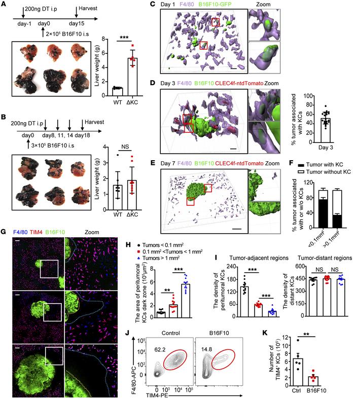 Loss of KCs preferentially in the tumor core and periphery at the late s...