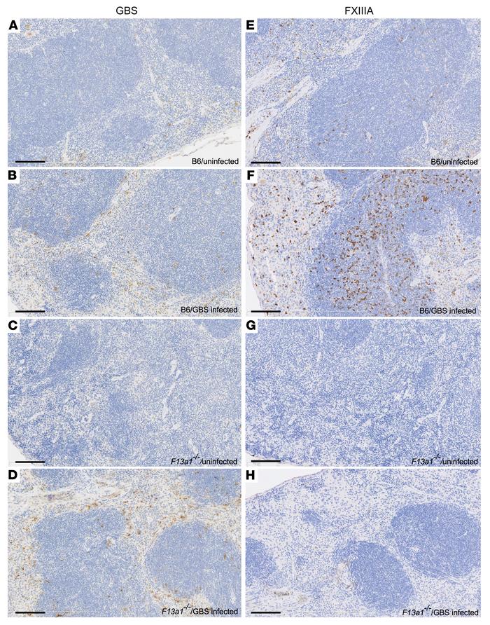 Increased FXIIIA staining in GBS-infected WT mice.
Uninfected and GBS-in...