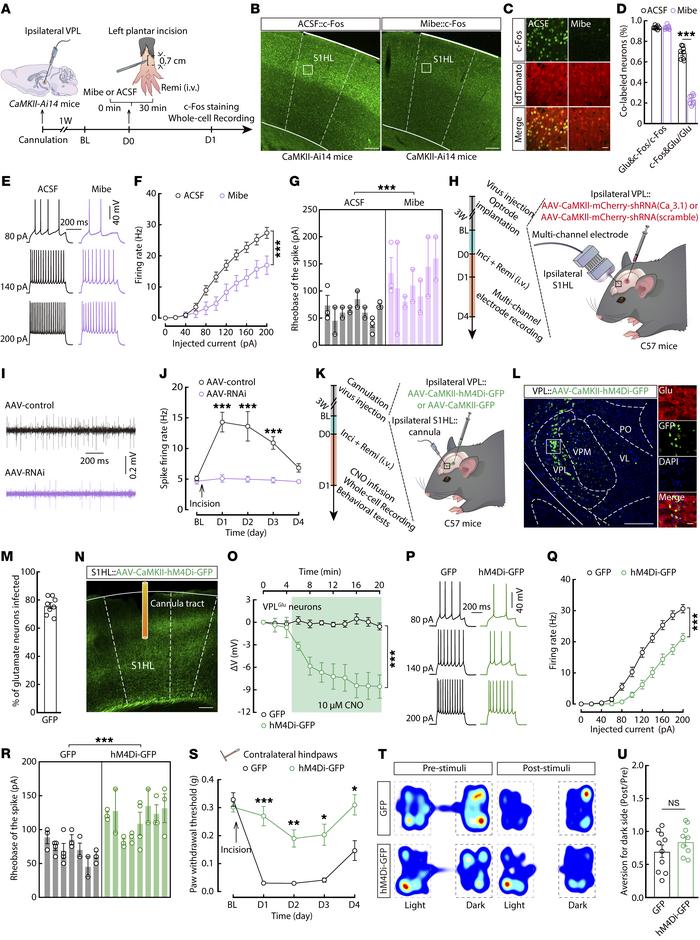 The VPLGlu

→ S1HLGlu circuit controls allodynia in RIH mice. (A) Schema...