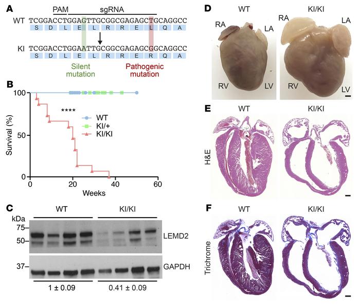 Cardiac abnormalities in KI/KI mice.
(A) WT and Lemd2 c.T38>G (KI) al...
