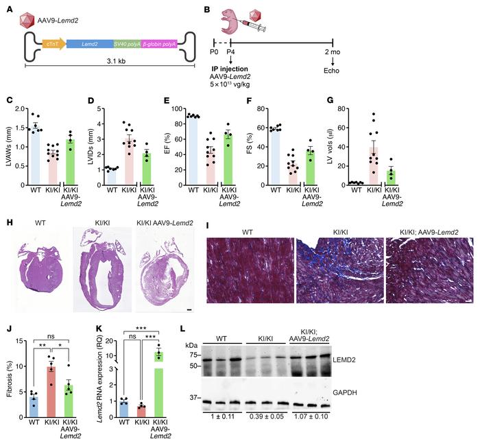 
Lemd2 gene therapy improves cardiac function in KI/KI mice.
(A) Schemat...