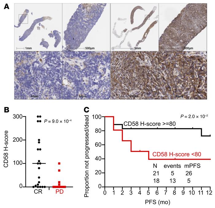 Prognostic role of pretreatment CD58 expression by IHC in patients with ...