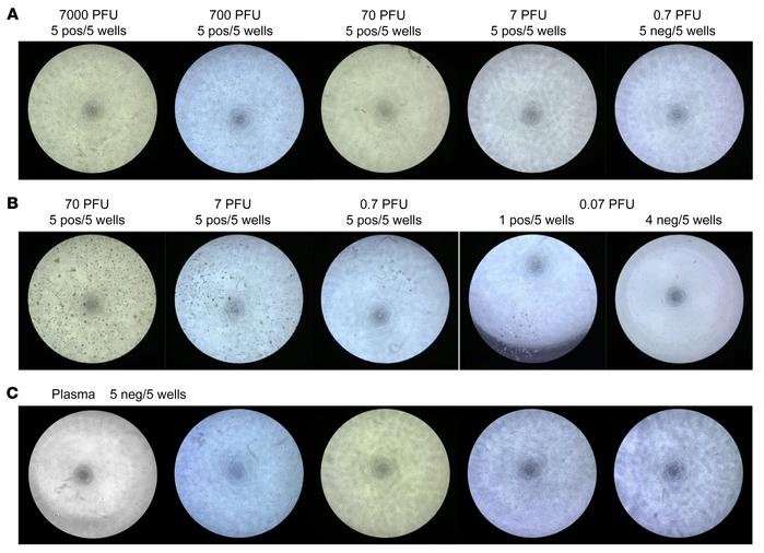 No viral replication after culture of SARS-CoV2 RNA–positive human plasm...