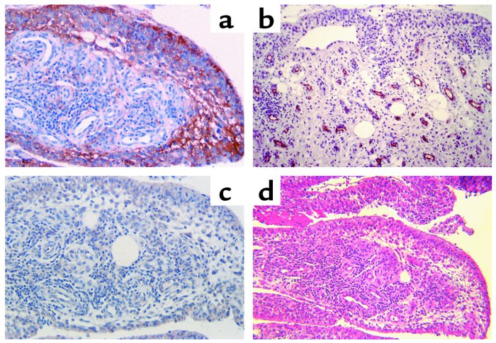 RANKL and OPG expression in the PsA synovium. Retrieval tissues containi...