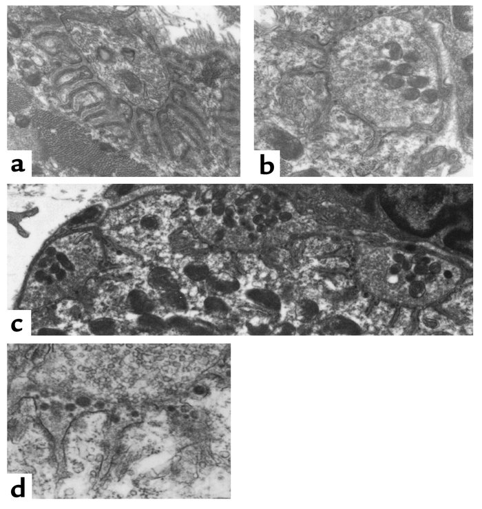 Electron micrographs of diaphragm neuromuscular junctions following inje...