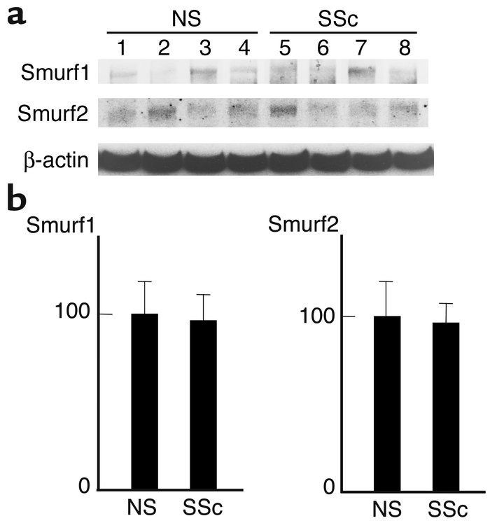 Comparison of the expression levels of Smurfs between normal and sclerod...