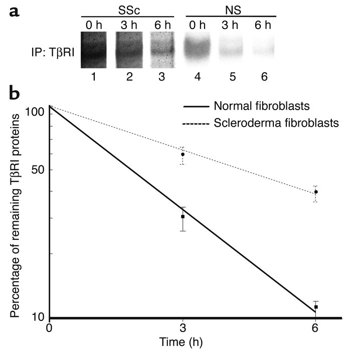 Comparison of the stability of TβRI protein between normal and scleroder...