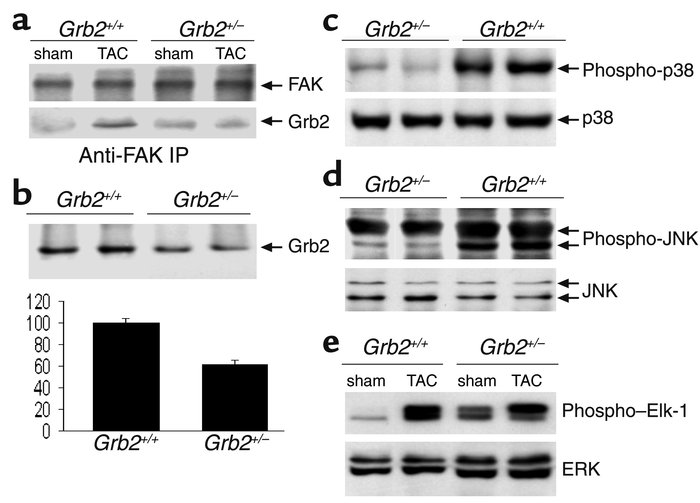 Biochemical characterization of Grb2 and MAPK in murine cardiac tissue 7...