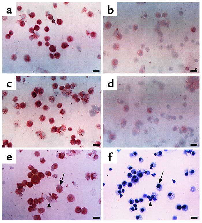 Localization of immunoreactive PTEN in BAL fluids of OVA-sensitized and ...