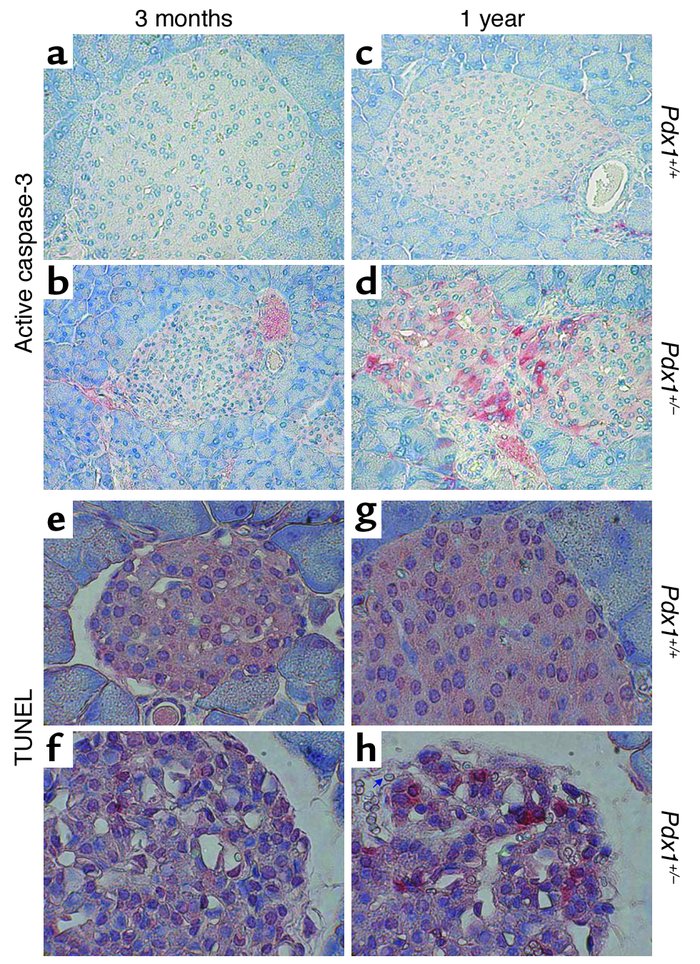 Immunohistochemistry for proapoptotic active caspase-3 and TUNEL. (a–d) ...