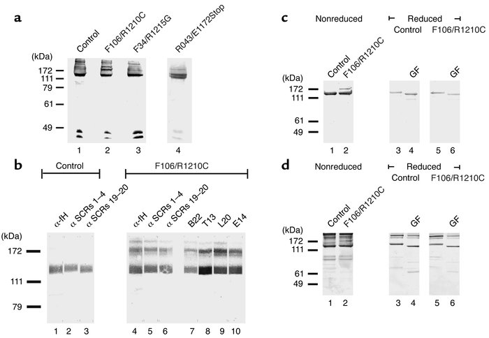 Identification of mutant factor H protein in serum of HUS patients. (a) ...