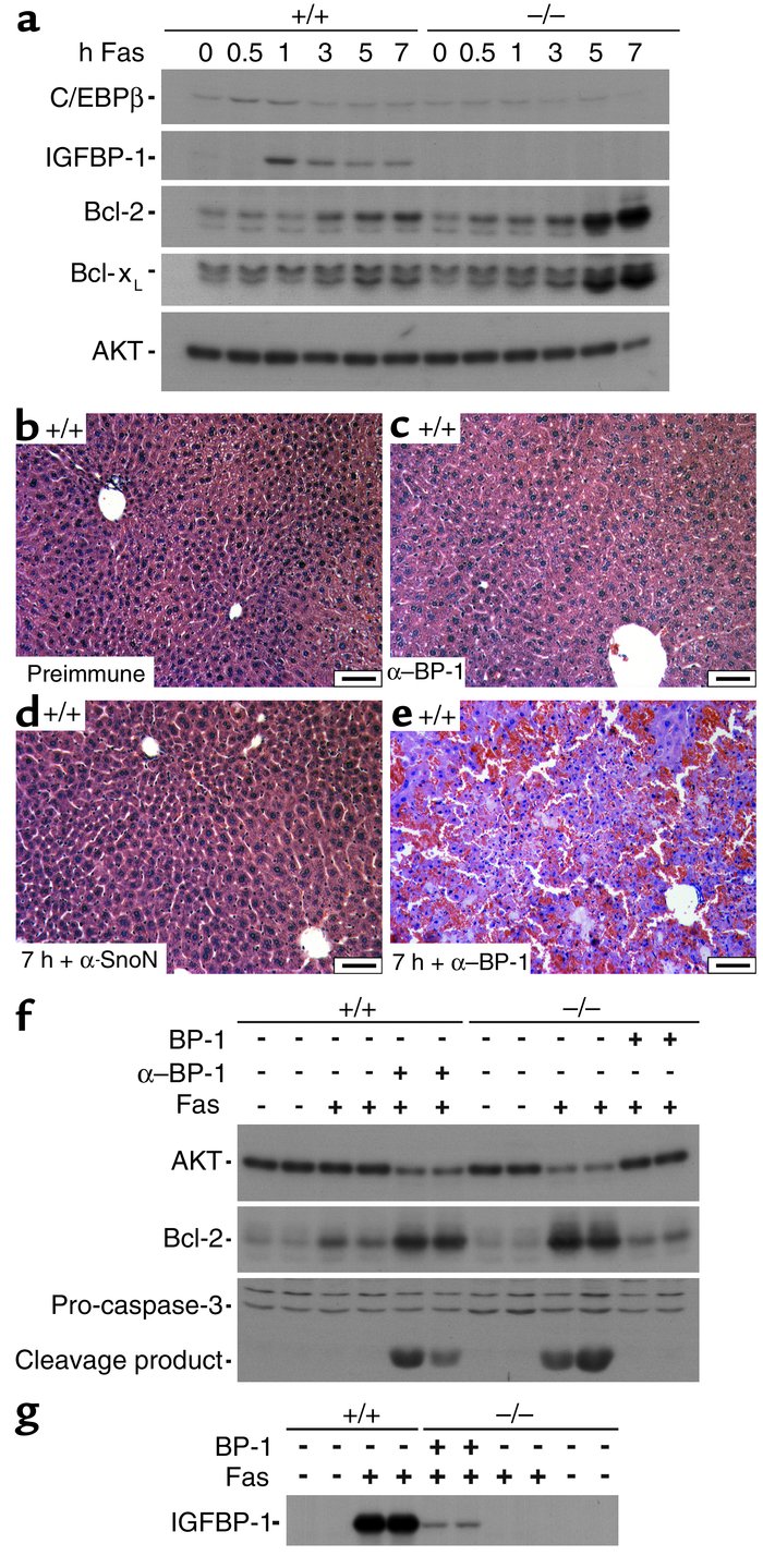 Low induction of C/EBPβ and enhanced expression of the major antiapoptot...