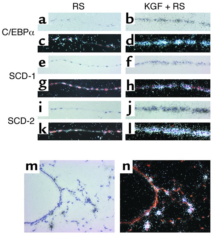 C/EBPα, SCD-1, and SCD-2 mRNA are increased in type II cells in response...