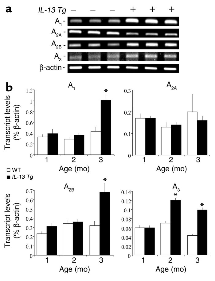 Alterations in adenosine receptor transcript levels in the lungs of IL-1...