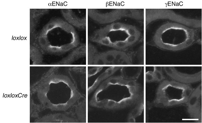 CNT profiles of kidneys from Scnn1aloxlox and Scnn1aloxloxCre mice kept ...