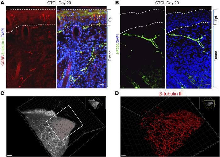 CTCL is associated with nerve innervations in mouse lymphoma.
(A) Double...
