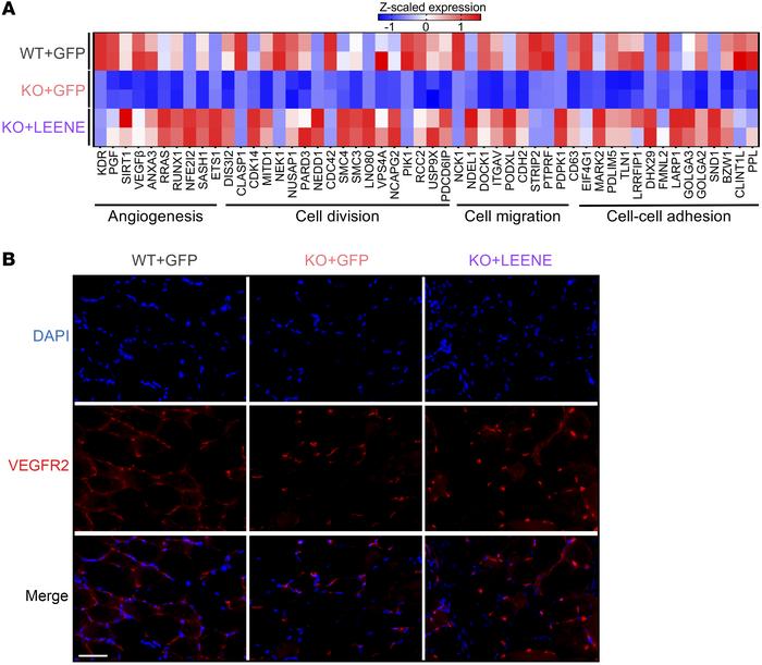 Human LEENE OE restores angiogenesis marker gene expression, including K...