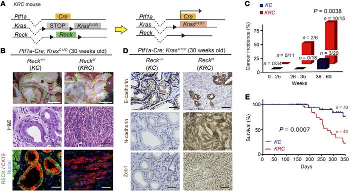 RECK suppresses spontaneous Kras-driven PDAC formation.
(A) Schematic re...