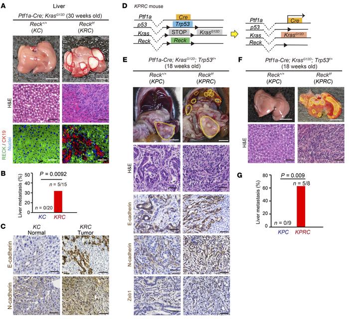 RECK suppresses spontaneous liver metastasis of PDAC.
(A) Morphology of ...