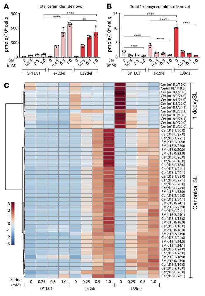 Sphingolipid (SL) signatures shift upon amino acid availability.
(A and ...