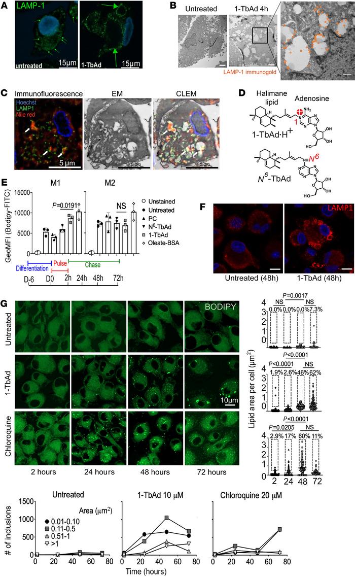 1-TbAd induces swelling of LAMP1 compartments and lipid overload in macr...