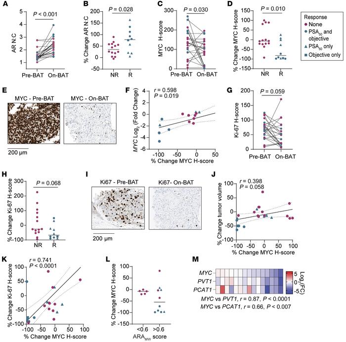 BAT downregulates MYC in responding patients.
(A) AR nuclear-to-cytoplas...