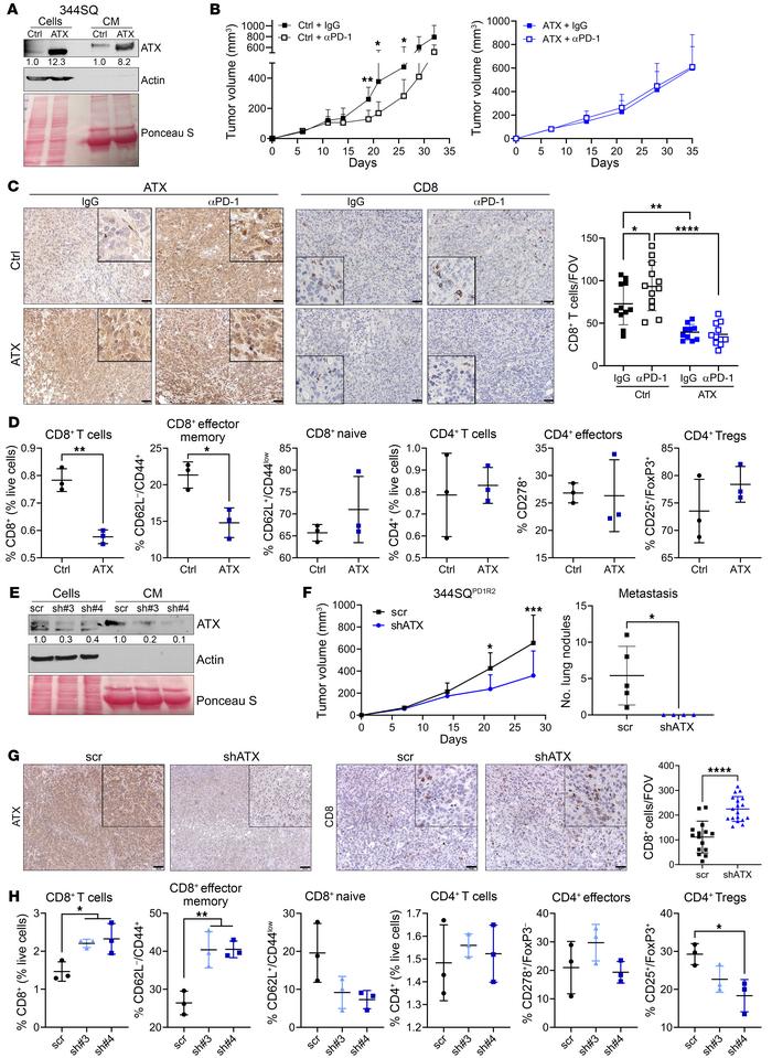 ATX expression negatively correlates with CD8+ T cell infiltration and e...